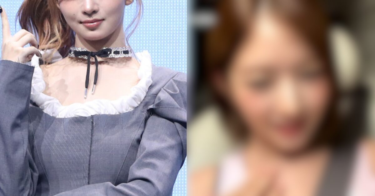 IVE成員Rei透露曾被要求除掉頸上的痣。