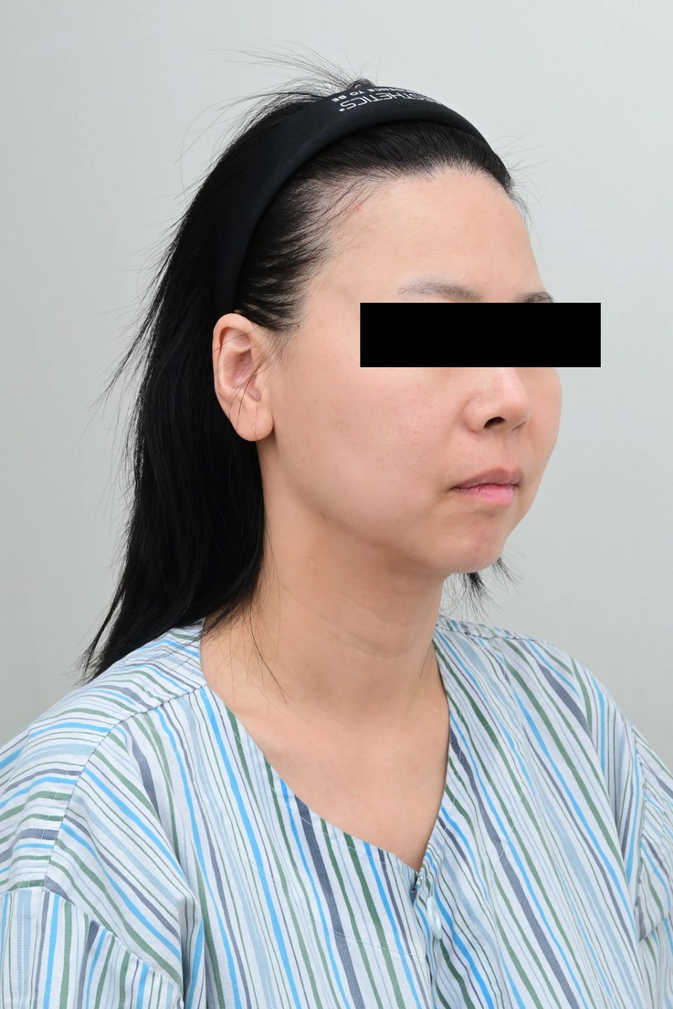 K-뷰티 시술 후기 만족도 핵심 요인