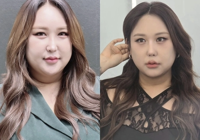 25㎏ 감량+5번째 코수술' 풍자, 몰라보게 예뻐진 근황